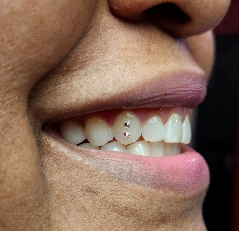 Two tooth gems placed side by side at Mindcrusher Tattoo, Rogers Park Chicago