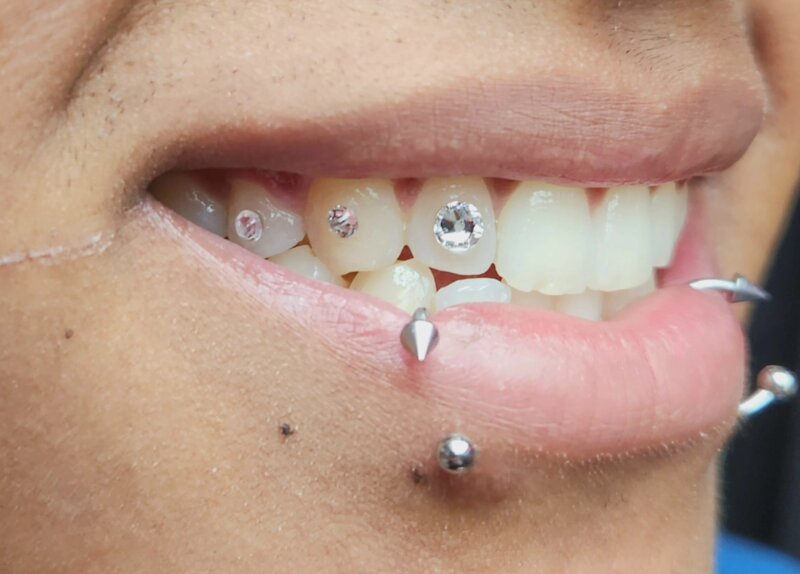Tooth gems and lip piercing combination done at Mindcrusher Tattoo, Rogers Park Chicago